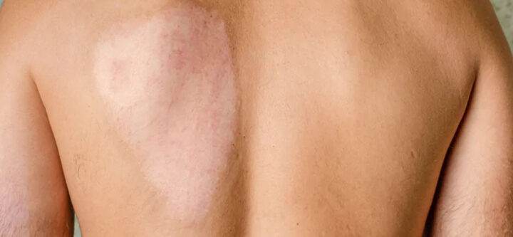 skin