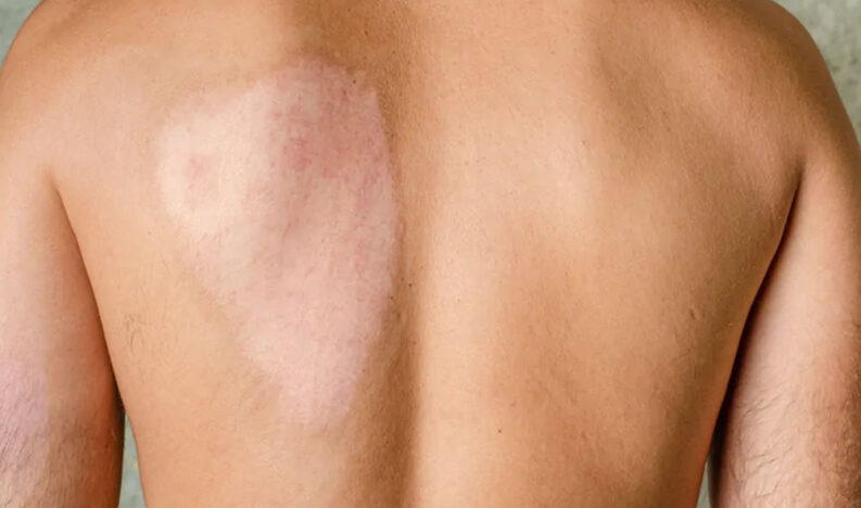 skin skin